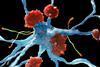 Alzheimer's nerve cells