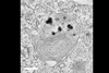 An image showing NPs in cancer lysosomes